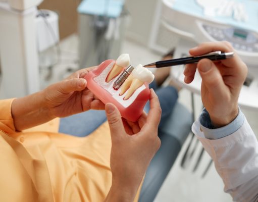 Zubné implantáty ako skvelé riešenie pre vás: Aké výhody prinášajú?